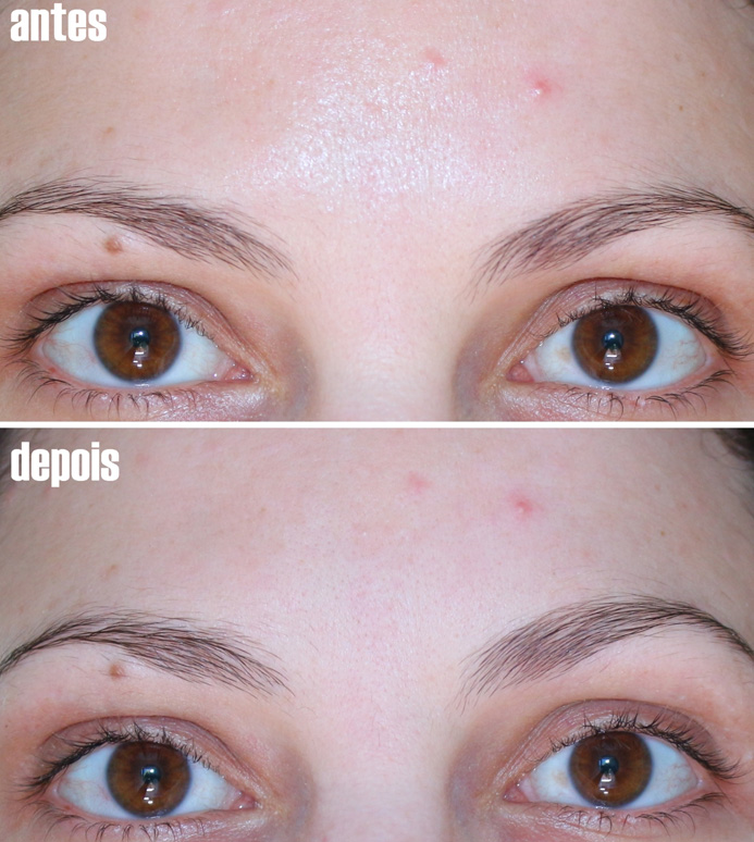 Leite de magnesia Philips como primer natural no combate a oleosidade ...