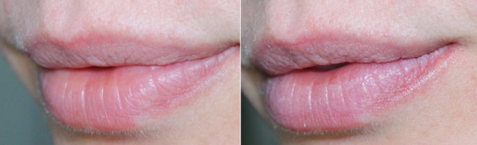 Resenha: Cicaplast Baume B5 La Roche PosayEu vou de Rosa- Cabelos e ...